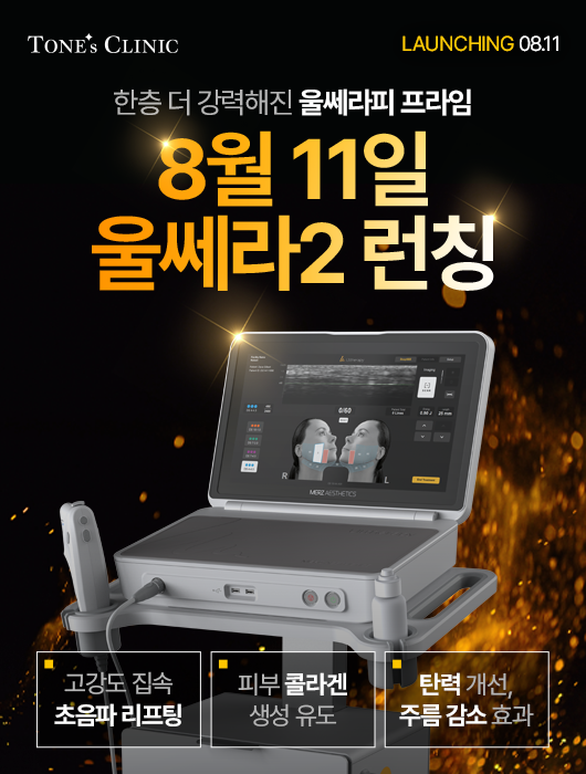 팝업